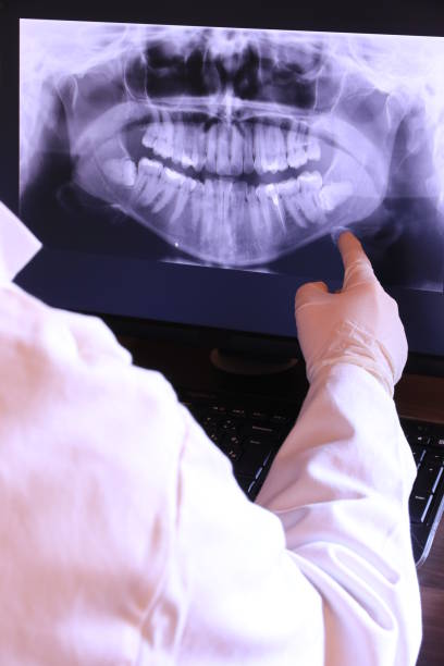 Best Emergency Gum Treatment in Montgomery, AL